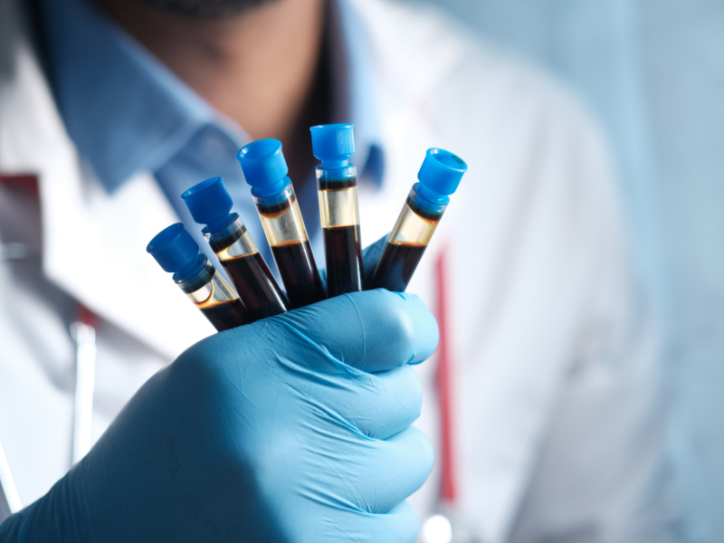 Order Local Lab Test